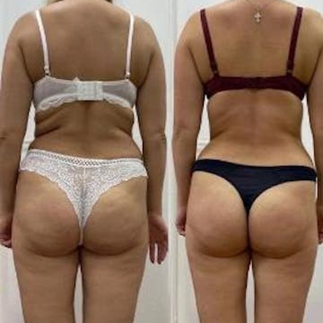 Incredible Results – So Happy I Gave It a Shot!